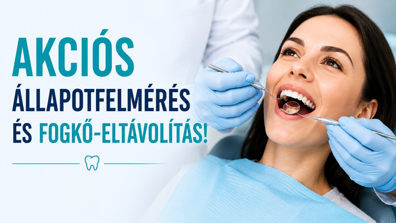 Akciós állapotfelmérés és fogkő-eltávolítás!